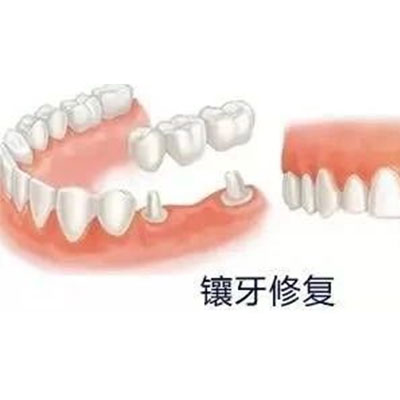 补牙的时候为什么要磨牙?