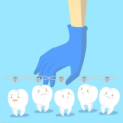 牙齿不整齐怎么办?带你了解牙齿矫正
