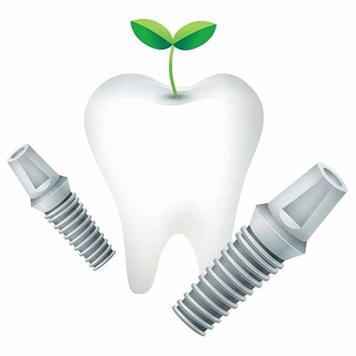 种植牙想用一生,这些“功课”你做了吗?