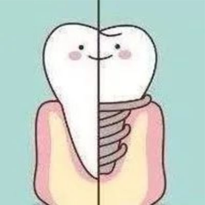 如何选择牙齿修复方式